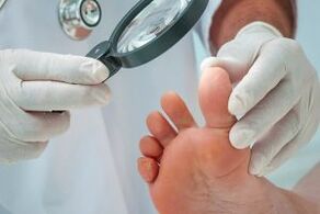 Plantar wart treatment