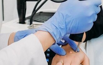 how to get rid of warts