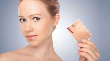 A review of effective drugs for warts and papillomas